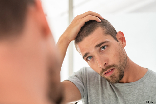 Male model checking hairline in mirror