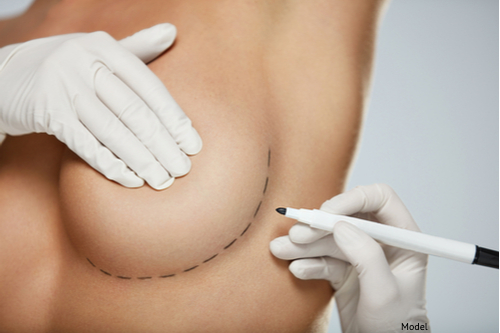 Woman preparing for her breast enhancement surgery with her surgeon.