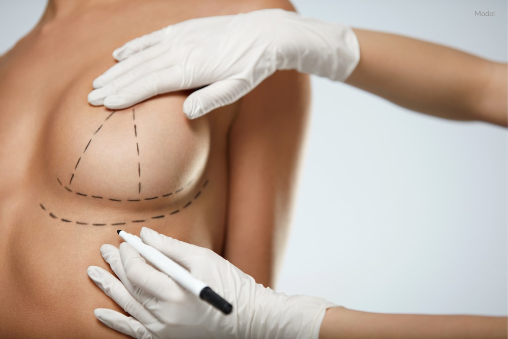 How Do Breast Implants Look After Pregnancy