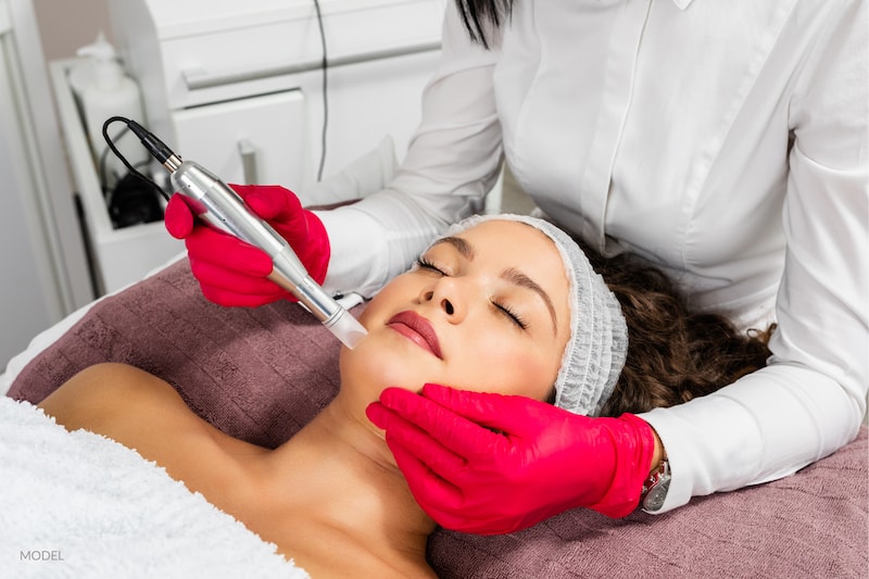 Women getting a microneedling treatment. Facelift surrounded by aesthetician with red gloves.