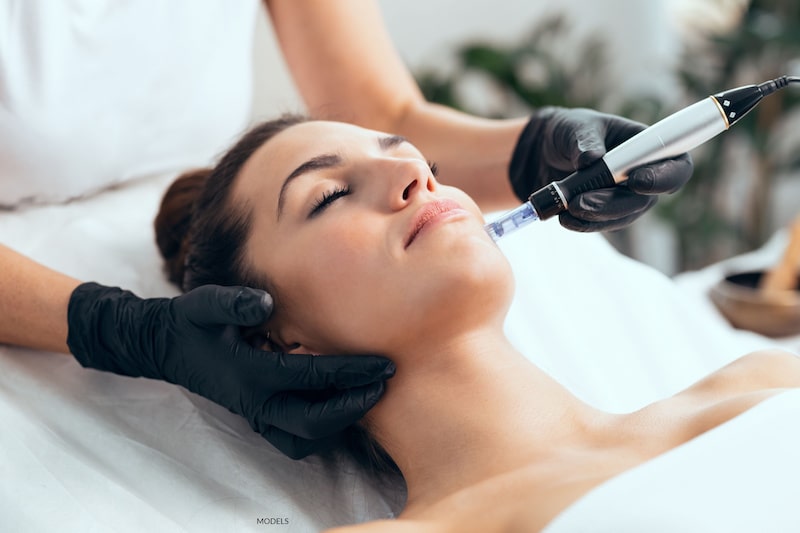 Beautiful woman relaxing while an aesthetician performs a microneedling treatment on her facial skin.