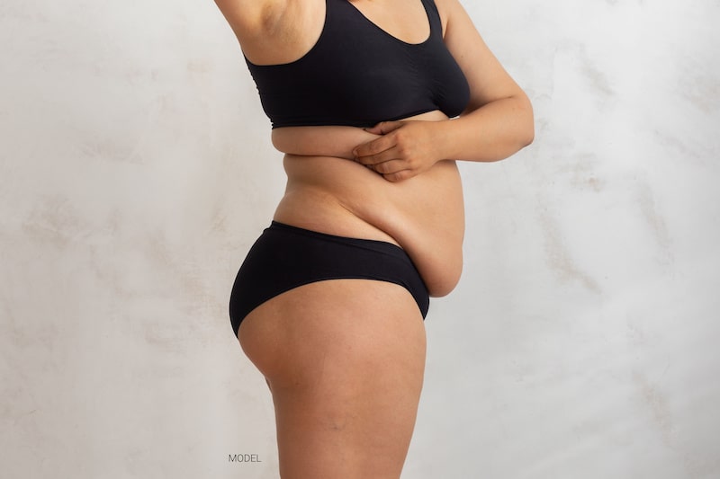 Profile of woman in black underwear with sagging skin in the midsection.