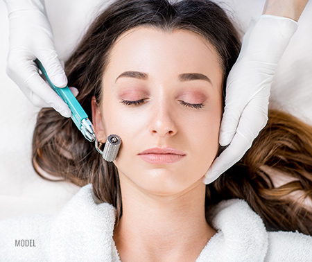 A woman receives and RF microneedling treatment.