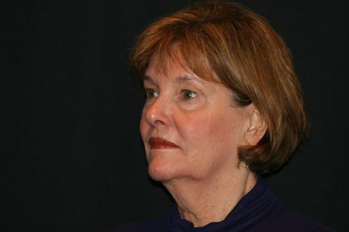 Before and After Facelift - Bonaldi Aesthetics Plastic Surgery & Med Spa